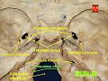 The hypoglossal nerve leaves the skull through the hypoglossal canal, which is situated near the large opening for the spinal cord, the foramen magnum.