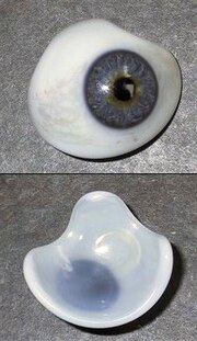 Miniatuur voor Oogprothese