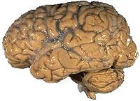 A human brain