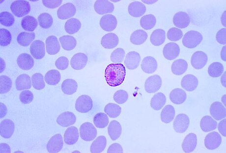 Plasmodium (Plasmodium) vivax