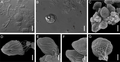 Parasite180057-fig3 Chloromyxum zearaji SEM.png