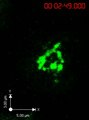 File:Remodelling-of-Cortical-Actin-Where-Lytic-Granules-Dock-at-Natural-Killer-Cell-Immune-Synapses-pbio.1001152.s006.ogv