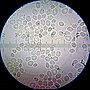 Miniatura para Saccharomyces cerevisiae