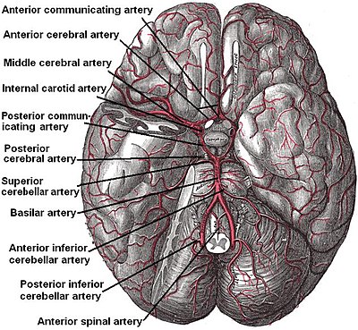 Cerebral hypoxia