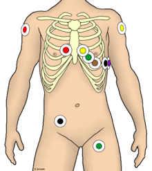 Enregistrement ECG dans les conditions des services de secours