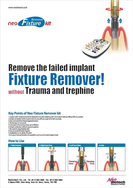 File:Fixture Remover.pdf