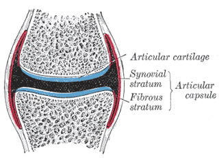 <span class="mw-page-title-main">Capsulitis</span> Inflammation of a joint capsule