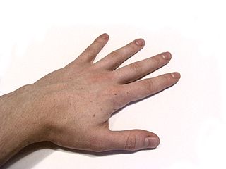 320px-Human_Hand.jpg