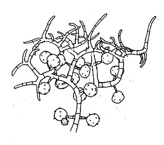 Sigmoideomycetaceae Family of fungi