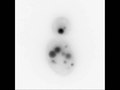 Payl:A-Role-for-Phosphatidic-Acid-in-the-Formation-of-“Supersized”-Lipid-Droplets-pgen.1002201.s005.ogv