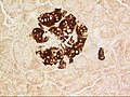 A pancreatic islet, showing beta cells.