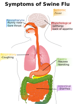 Миниатюра для Файл:Diagram of swine flu symptoms.svg