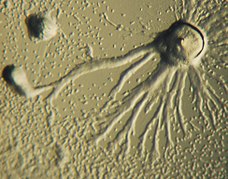 Seudoplasmodio de Dictyostelium discoideum (Mycetozoa)