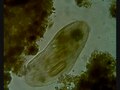 Fayl: Frontonia diatom.ogv-ni yutmoqda