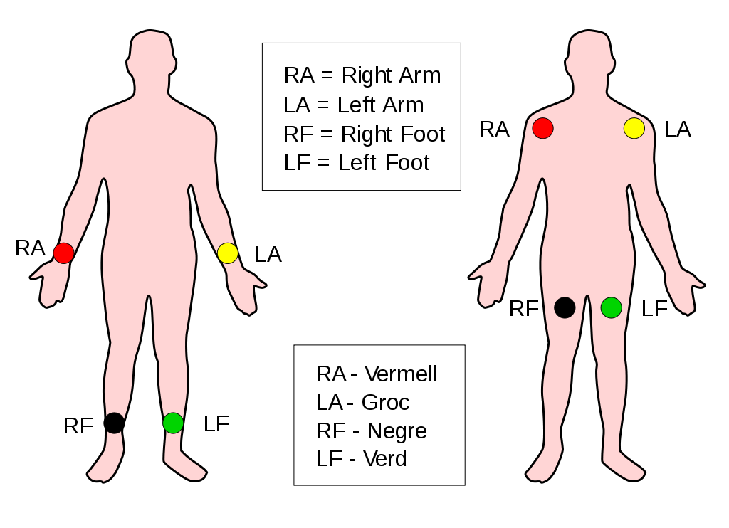 File:Limb leads 2 0 - Wikimedia Commons