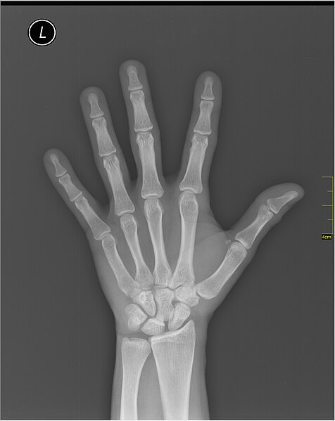 File:Medical X-Ray imaging TUH07 nevit.jpg