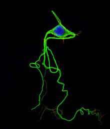 Нейрон курячого ембріона, сфотографований конфокальним мікроскопом