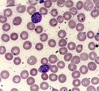 <span class="mw-page-title-main">Leishman stain</span> Diagnostic technique