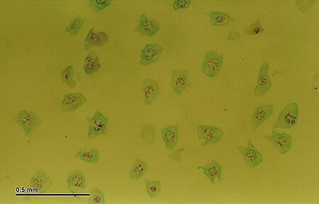 Fail:Polytene chromosomes (260 07) Salivary glands of nonbiting midges larvae (Chironomidae).jpg