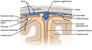 Thumbnail for Cerebrospinal fluid leak