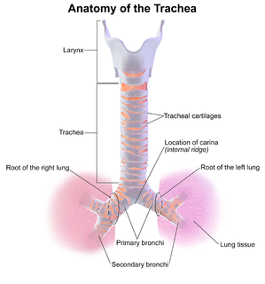 Tracheobronchomalacia congenital disorder of respiratory system