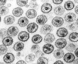 Electron micrograph of the human immunodeficiency virus. HIV/AIDS denialists dispute the existence of HIV or its role in causing AIDS. HIV-1 Transmission electron micrograph AIDS02bbb lores.jpg