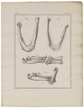 Homo sapiens - Afwijking - 1700-1880 - Print - Iconographia Zoologica - Special Collections University of Amsterdam - UBA01 IZ19600218.tif