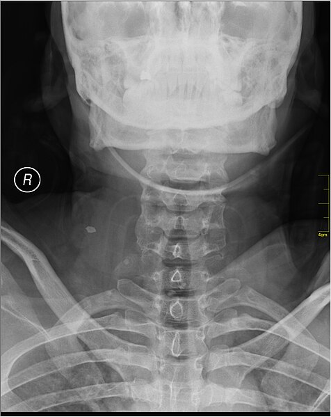 File:Medical X-Ray imaging IMJ05 nevit.jpg