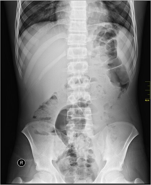 File:Medical X-Ray imaging VVN07 nevit.jpg