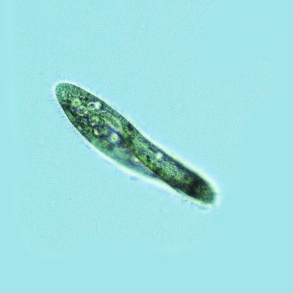 Paramecium tetraurelia, a ciliate, with oral groove visible