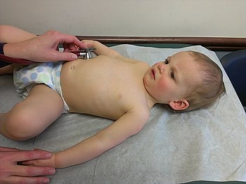 Examination of the abdomen of a child. Physical examination of child, age 15 months.jpeg