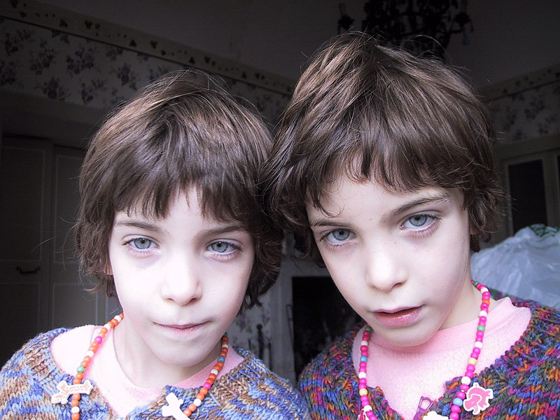 File:Twins - Flickr - Gabuchan.jpg