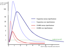 Cinétique des marqueurs cardiaques dans l'infarctus du myocarde avec et sans traitement de reperfusion