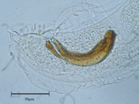 Aelurostrongylus falciformis.png