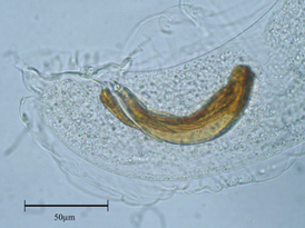 Aelurostrongylus falciformis