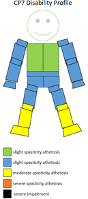 The spasticity athetosis level and location of a CP7 sportsperson. CP7 disability profile.png