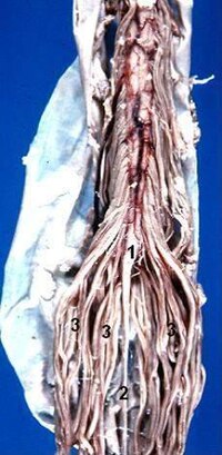 Human caudal spinal chord anterior view description.JPG