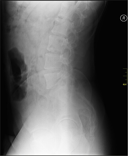 File:Medical X-Ray imaging AHB02 nevit.jpg