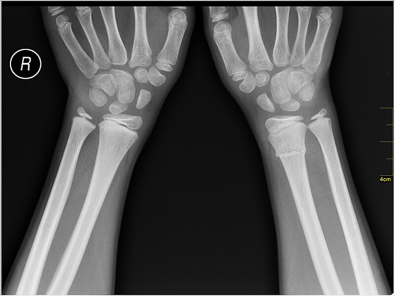 File:Medical X-Ray imaging SRF07 nevit.jpg