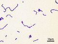 Streptococcus mutans Gram.jpg