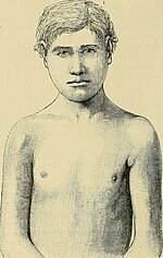 Thumbnail for File:The diseases of children - medical and surgical (1900) (14783902602).jpg