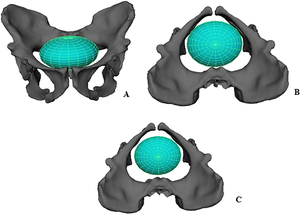 Australopithecus Sediba