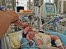 Бебешки белодробен симулатор LuSi (неозим)
