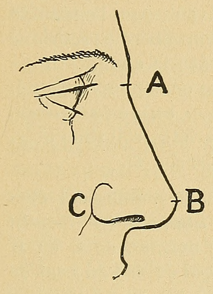 File:Bertillon - Identification anthropométrique (1893) 155.png