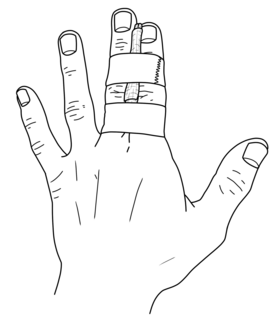 Buddy-taping-finger.png