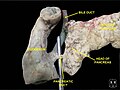 Deep dissection of bile duct, anterior view