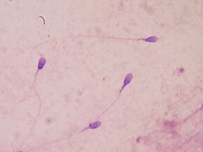 Image result for human sperm, wikipedia