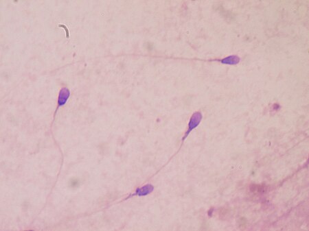 ไฟล์:Sperm_stained.JPG