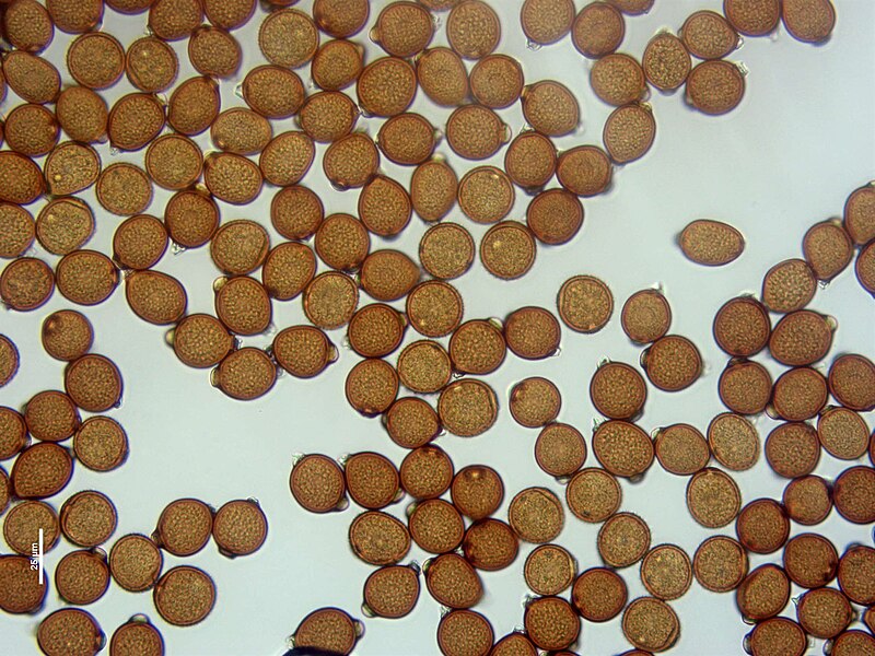 File:Trachyspora intrusa (39).jpg