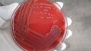 Thumbnail for File:Bacterial growth on blood agar.jpg